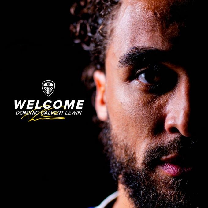 DOMINIC CALVERT-LEWIN