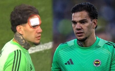 Ederson'a yabanc� madde!