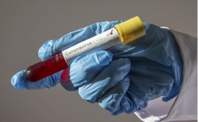 Kovid-19'u ağır geçirenlerin genetik şifresi çözüldü