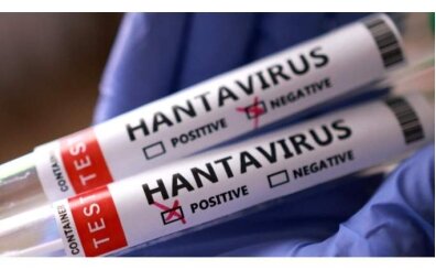 Hantavir�s T�rkiye'de var m�? Hangi illerde g�r�ld�? 
