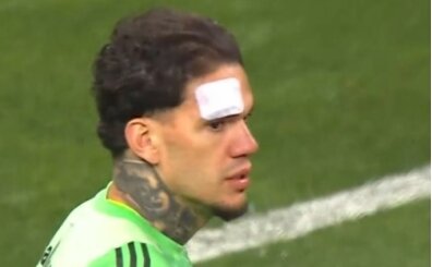 Fenerbah�e'den Ederson'a yabanc� madde i�in a��klama